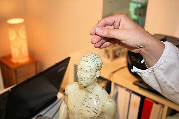 Foto Kopfakupunktur an der Akupunkturpuppe in Krefeld